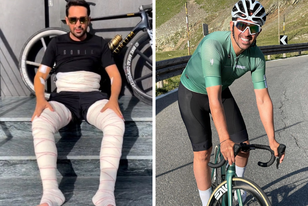 Alberto Contador se fait op&eacute;rer de 100 tumeurs b&eacute;nignes