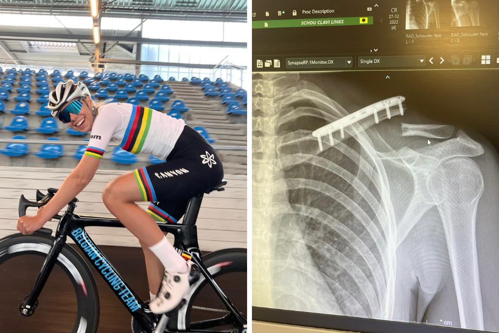 Shari Bossuyt se casse la clavicule &agrave; l&rsquo;entra&icirc;nement