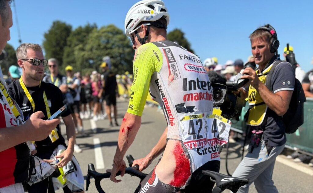 Les stigmates impressionnants de Louis Barr&eacute; apr&egrave;s sa chute survenue lors de la 7e &eacute;tape du Tour de France 2025